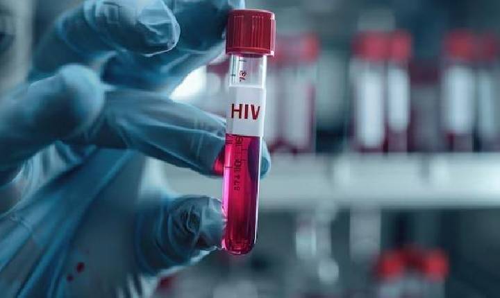 Seis pessoas testam positivo para HIV após receberem órgãos transplantados